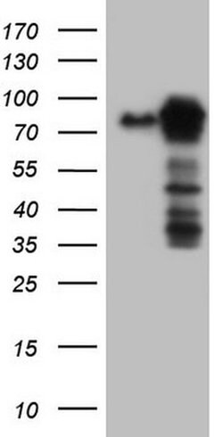 MTDH Monoclonal Antibody (OTI1H1), TrueMAB , OriGene 100 &mu;L; Unconjugated:Antibodies,