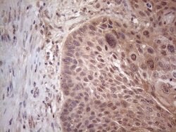 MTF1 Mouse anti-Human, Clone: OTI2F3, lyophilized, TrueMAB 100 &mu;g; Unconjugated:Antibodies,
