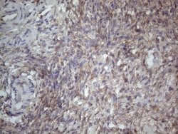 MTF1 Mouse anti-Human, Clone: OTI2F3, lyophilized, TrueMAB 100 &mu;g; Unconjugated:Antibodies,