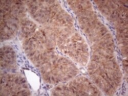 MTF1 Mouse anti-Human, Clone: OTI2F3, lyophilized, TrueMAB 100 &mu;g; Unconjugated:Antibodies,