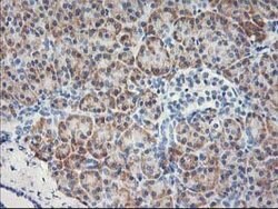 MTFMT Mouse anti-Human, Clone: OTI1C1, lyophilized, TrueMAB 100 &mu;g;
