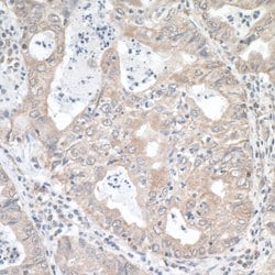 MTHFR Rabbit anti-Human, Polyclonal, Bethyl Laboratories 10 &mu;L; Unconjugated:Antibodies,