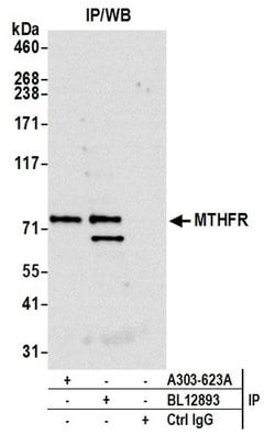 MTHFR Rabbit anti-Human, Polyclonal, Bethyl Laboratories 10 &mu;L; Unconjugated:Antibodies,