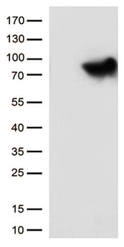 MTHFR Mouse anti-Human, Clone: OTI3H5, lyophilized, TrueMAB 100 &mu;g;