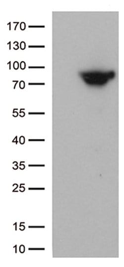 MTHFR Mouse anti-Human, Clone: OTI4D2, lyophilized, TrueMAB 100 &mu;g;