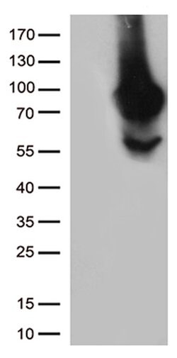 MTHFR Mouse anti-Human, Clone: OTI2H3, lyophilized, TrueMAB 100 &mu;g;