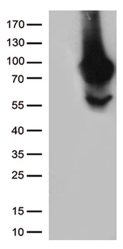 MTHFR Monoclonal Antibody (OTI2H3), TrueMAB , OriGene 100 &mu;L; Unconjugated:Antibodies,