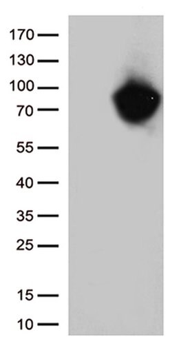 MTHFR Monoclonal Antibody (OTI4C5), TrueMAB , OriGene 100 &mu;L; Unconjugated:Antibodies,