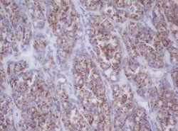 MTIF3 Monoclonal Antibody (OTI4G2), TrueMAB , OriGene:Antibodies:Primary