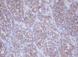 MTIF3 Monoclonal Antibody (OTI1D6), TrueMAB , OriGene 100 &mu;L; Unconjugated:Antibodies,