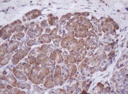 MTIF3 Monoclonal Antibody (OTI4B6), TrueMAB , OriGene 100 &mu;L; Unconjugated:Antibodies,