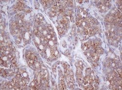 MTIF3 Monoclonal Antibody (OTI4B6), TrueMAB , OriGene 100 &mu;L; Unconjugated:Antibodies,
