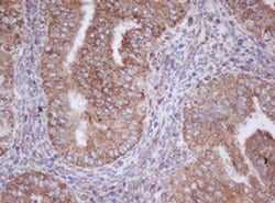 MTIF3 Monoclonal Antibody (OTI4B6), TrueMAB , OriGene 100 &mu;L; Unconjugated:Antibodies,