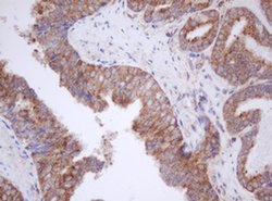 MTIF3 Monoclonal Antibody (OTI4B6), TrueMAB , OriGene 100 &mu;L; Unconjugated:Antibodies,