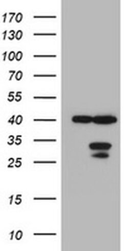 MTIF3 Monoclonal Antibody (OTI1D9), TrueMAB , OriGene 100 &mu;L; Unconjugated:Antibodies,