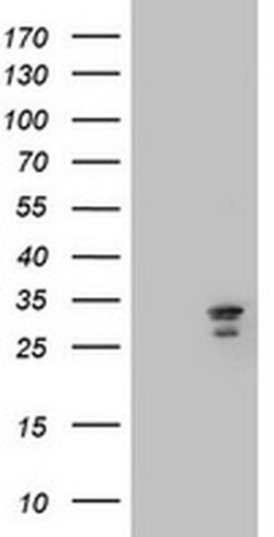 MTIF3 Monoclonal Antibody (OTI4G2), TrueMAB , OriGene:Antibodies:Primary
