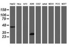 MTIF3 Monoclonal Antibody (OTI3E10), TrueMAB , OriGene 100 &mu;L; Unconjugated:Antibodies,