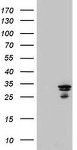 MTIF3 Monoclonal Antibody (OTI4B6), TrueMAB , OriGene 100 &mu;L; Unconjugated:Antibodies,