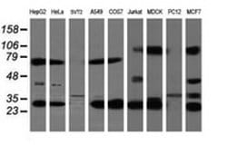 MTIF3 Monoclonal Antibody (OTI4B6), TrueMAB , OriGene 100 &mu;L; Unconjugated:Antibodies,
