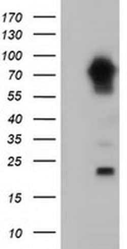 MTMR14 Monoclonal Antibody (OTI9G9), TrueMAB , OriGene 30 &mu;L; Unconjugated:Antibodies,