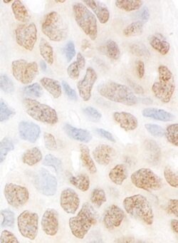 MTMR15 Rabbit anti-Human, Polyclonal, Bethyl Laboratories 100 &mu;L; Unconjugated:Antibodies,