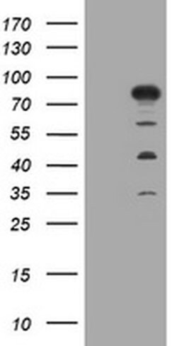 MTMR2 Monoclonal Antibody (OTI1F10), TrueMAB , OriGene 30 &mu;L; Unconjugated:Antibodies,