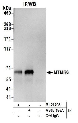 MTMR6 Rabbit anti-Human, Polyclonal, Bethyl Laboratories 100 &mu;L; Unconjugated:Antibodies,