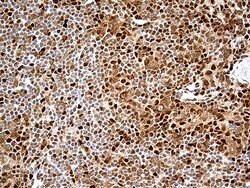 MTOR Monoclonal Antibody (OTI1C3), TrueMAB , OriGene 100 &mu;L; Unconjugated:Anticuerpos