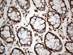MTOR Monoclonal Antibody (OTI1C3), TrueMAB , OriGene 100 &mu;L; Unconjugated:Anticuerpos