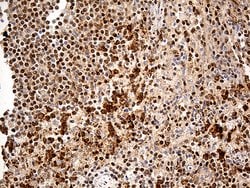 MTOR Monoclonal Antibody (OTI1C3), TrueMAB , OriGene 100 &mu;L; Unconjugated:Anticuerpos