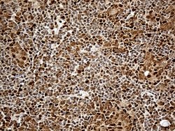 MTOR Mouse anti-Human, Clone: OTI3E5, lyophilized, TrueMAB 100 &mu;g; Unconjugated:Antibodies,