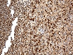 MTOR Mouse anti-Human, Clone: OTI3E5, lyophilized, TrueMAB 100 &mu;g; Unconjugated:Antibodies,