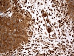 MTOR Mouse anti-Human, Clone: OTI3E5, lyophilized, TrueMAB 100 &mu;g; Unconjugated:Antibodies,