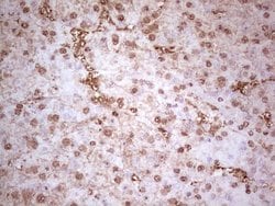 MTOR Mouse anti-Human, Clone: OTI3E5, lyophilized, TrueMAB 100 &mu;g; Unconjugated:Antibodies,