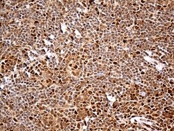 MTOR Monoclonal Antibody (OTI5B3), TrueMAB , OriGene 30 &mu;L; Unconjugated:Antibodies,