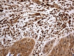 MTOR Monoclonal Antibody (OTI5B3), TrueMAB , OriGene 30 &mu;L; Unconjugated:Antibodies,