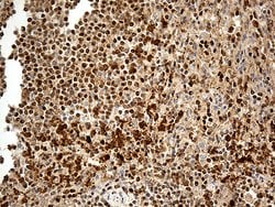 MTOR Monoclonal Antibody (OTI4A7), TrueMAB , OriGene 100 &mu;L; Unconjugated:Antibodies,