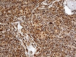 MTOR Monoclonal Antibody (OTI5B1), TrueMAB , OriGene 100 &mu;L; Unconjugated:Antibodies,