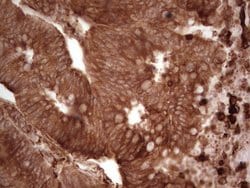MTOR Monoclonal Antibody (OTI5B8), TrueMAB , OriGene 100 &mu;L; Unconjugated:Antibodies,