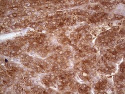 MTOR Monoclonal Antibody (OTI5B8), TrueMAB , OriGene:Antibodies:Primary