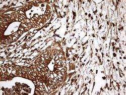 MTOR Mouse anti-Human, Clone: OTI4A6, lyophilized, TrueMAB 100 &mu;g; Unconjugated:Antibodies,