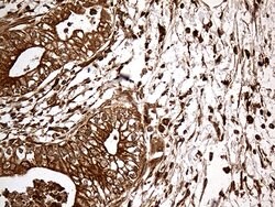 MTOR Monoclonal Antibody (OTI4A6), TrueMAB , OriGene 100 &mu;L; Unconjugated:Antibodies,