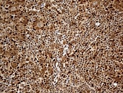 MTOR Monoclonal Antibody (OTI4A6), TrueMAB , OriGene 100 &mu;L; Unconjugated:Antibodies,