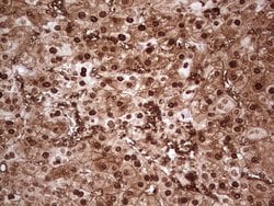 MTOR Monoclonal Antibody (OTI4A6), TrueMAB , OriGene 100 &mu;L; Unconjugated:Antibodies,