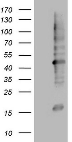 MTOR Mouse anti-Human, Clone: OTI1D5, lyophilized, TrueMAB 100 &mu;g; Unconjugated:Antibodies,