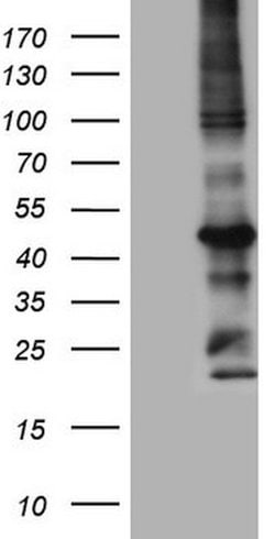 MTOR Mouse anti-Human, Clone: OTI3E5, lyophilized, TrueMAB 100 &mu;g; Unconjugated:Antibodies,