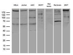 MTOR Mouse anti-Human, Clone: OTI3E5, lyophilized, TrueMAB 100 &mu;g; Unconjugated:Antibodies,