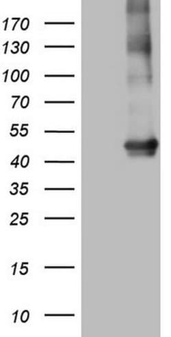 MTOR Monoclonal Antibody (OTI5B3), TrueMAB , OriGene 30 &mu;L; Unconjugated:Antibodies,