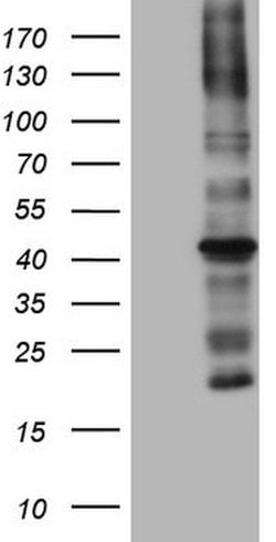 MTOR Mouse anti-Human, Clone: OTI4A6, lyophilized, TrueMAB 100 &mu;g; Unconjugated:Antibodies,