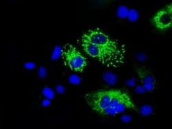 MTRF1L Monoclonal Antibody (OTI1C5), TrueMAB , OriGene 100 &mu;L; Unconjugated:Antibodies,